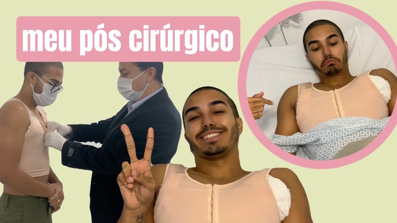 Watch Now DIÁRIO DA MINHA PRÓTESE DE PEITORAL (PARTE 2) DIÁRIO DA MINHA PRÓTESE DE PEITORAL (PARTE 2)