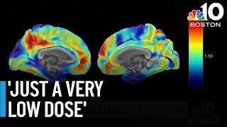 New Alzheimer's study finds simple treatment could restore memory