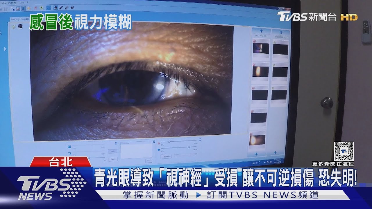 眼睛突然痛到受不了下場慘 醫師:染上「這疾病」失明風險高