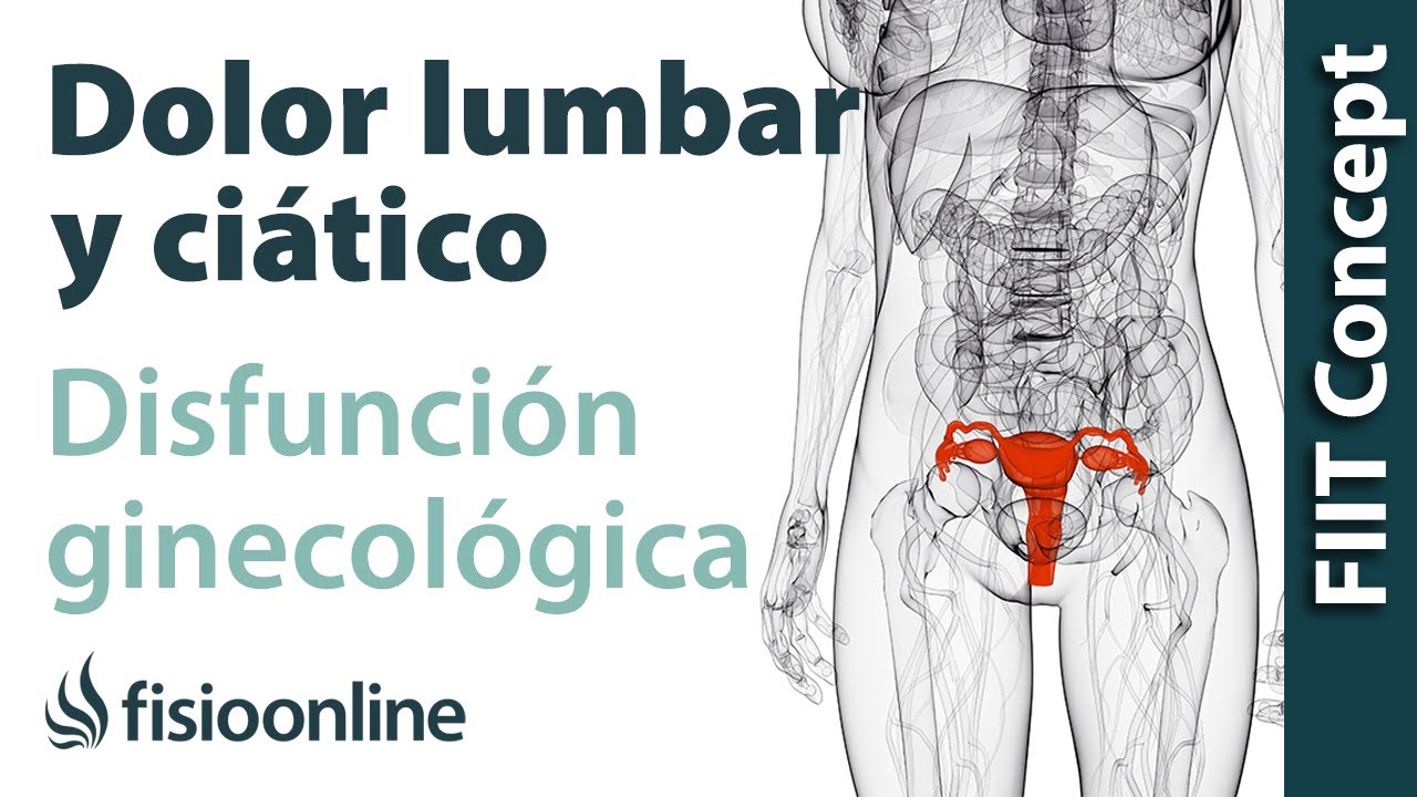 Disfunciones ginecológicas y dolor de espalda lumbar y ciático - Causas y tratamiento