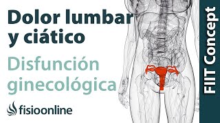 Disfunciones ginecológicas y dolor de espalda lumbar y ciático -  Causas y tratamiento