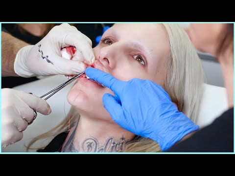 download lagu mp3 mp4 Jeffree Star Surgery, download lagu Jeffree Star Surgery gratis, unduh video klip Jeffree Star Surgery
