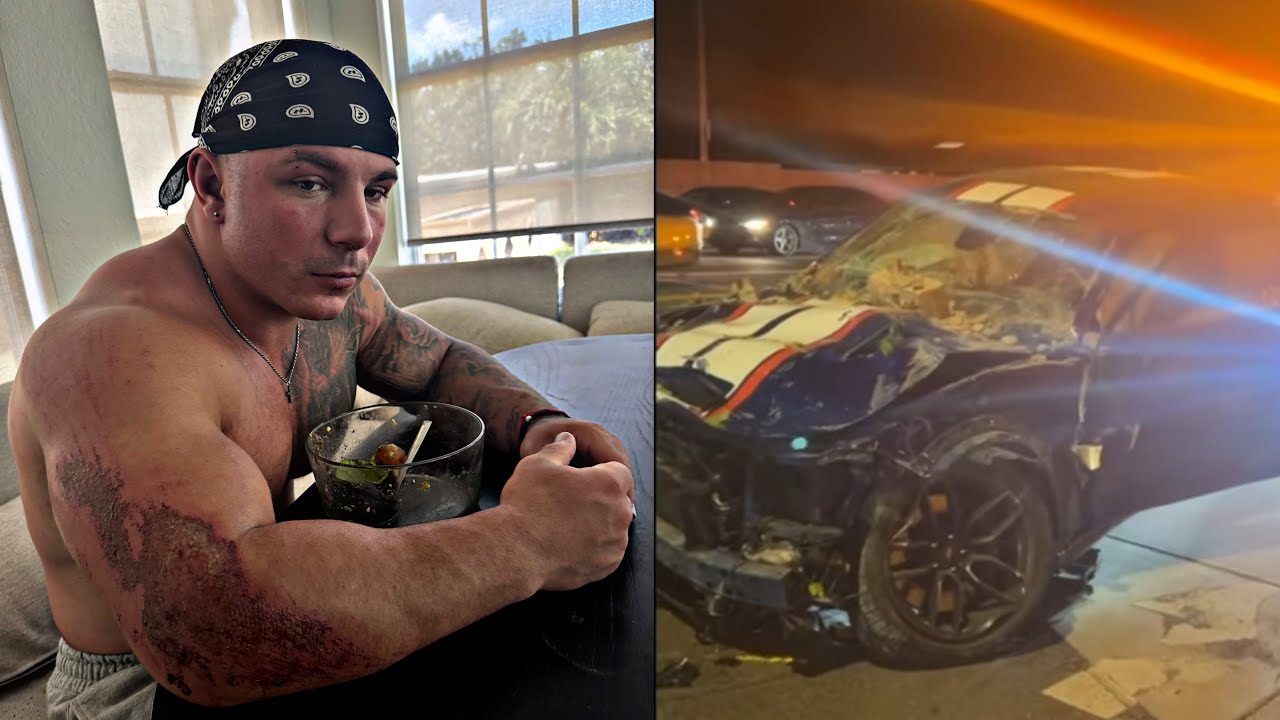 CONCUSSION, TORN SKIN, AND HEAVY LIFTING