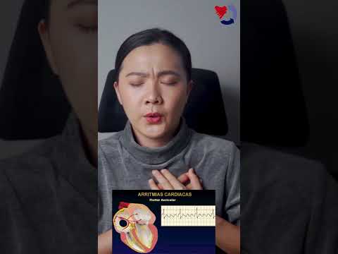 Síntomas de arritmias cardiácas