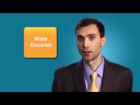 Melanoma Treatment: A Patient Video Guide - Early Stage Melanoma (Part 1 of 4)
