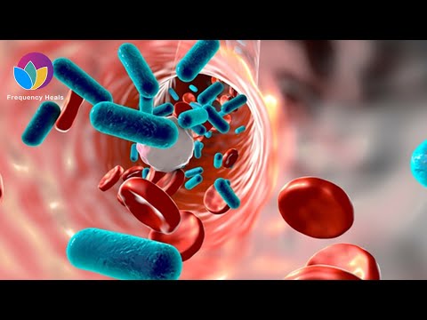 Bacteremia Treatment | Eliminate Bacteria in the Blood & Relieve Infections