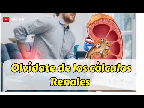 9 Remedios caseros para eliminar cálculos renales.