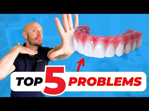 BUYERS BEWARE🚨 All-on-4 Dental Implants