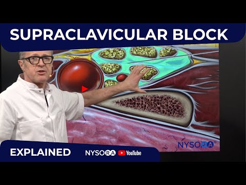 Supraclavicular Block - Regional anesthesia Crash course with Dr. Hadzic