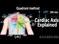 Cardiac Axis Interpretation Animation