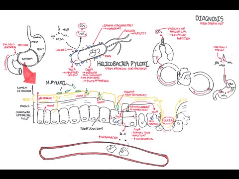 comment traiter helicobacter pylori