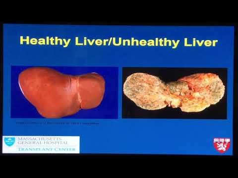 Liver Disease Overview