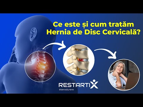 Scapă de durerile de cap cauzate de postură