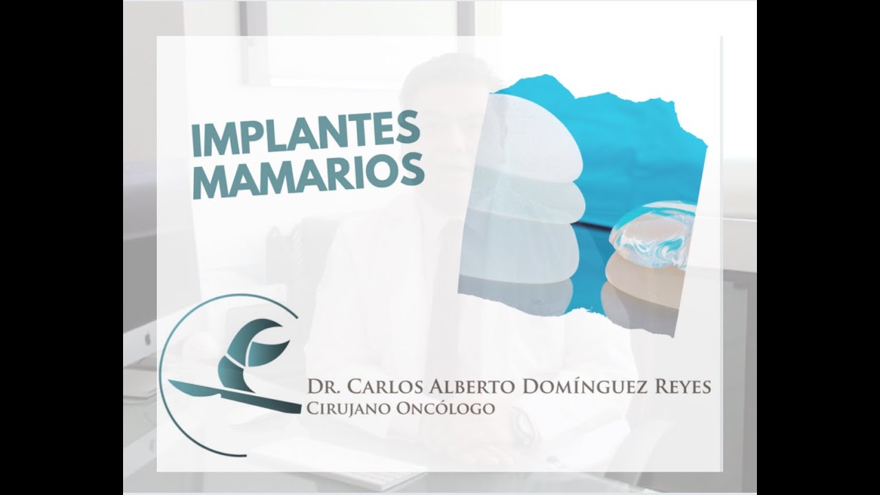 Carlos Alberto Domínguez Reyes-7