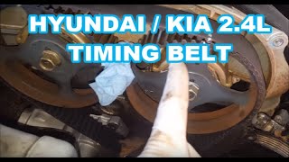 Hyundai/KIA Timing Belt Replacement 2.4L  99-06 SONATA, OPTIMA, SANTA FE water pump