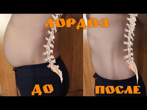 Осанка мужчины фото Упражнения для восстановления правильной осанки