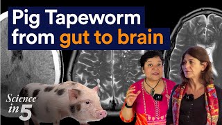 Science in 5, Episode 145 - PIG TAPEWORM