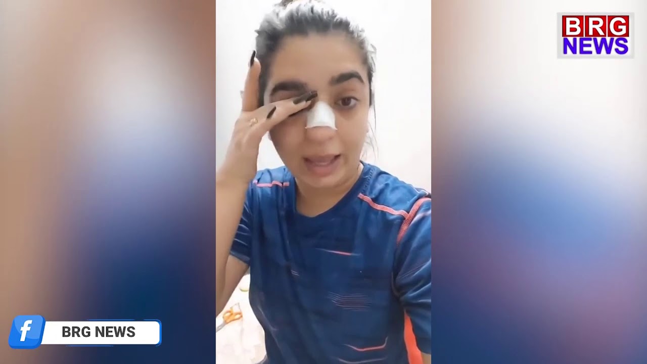 Bengaluru woman says Zomato delivery boy hit her Nose after delay in order,Delivery Boy ने उठाया हाथ