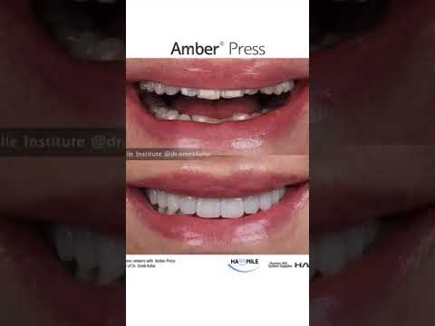 HASSthetics Clinical Video Series 2. Amber Press