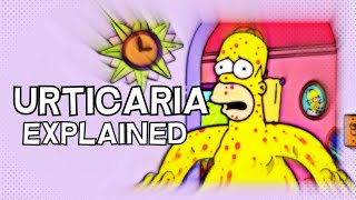What is Urticaria (Hives) - EXPLAINED IN 3 MINUTES