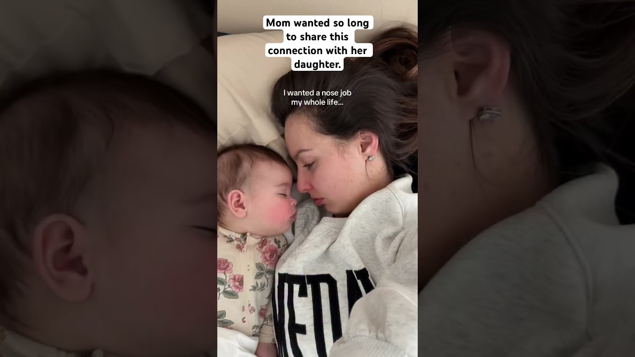 Mom wanted a nose job and she had a perfect once with her daughter #mother #baby #mother daughter