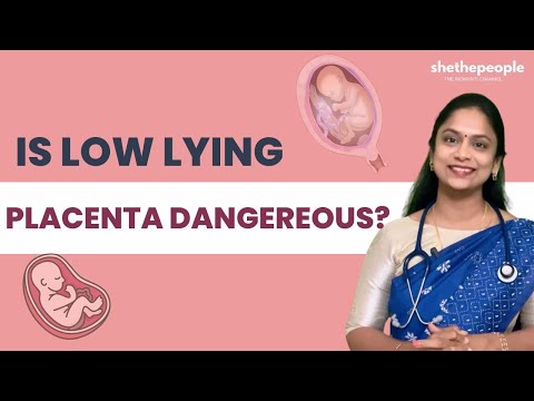 Can Low Lying Placenta Harm Your Fetus? | She The People