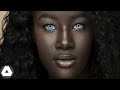 10 Rarest Black People Who Are 1 In A Million