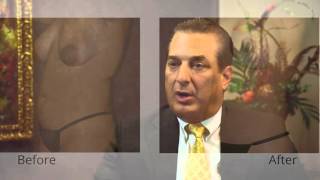 Psychological Benefits of Cosmetic Surgery After Pregnancy & Childbirth