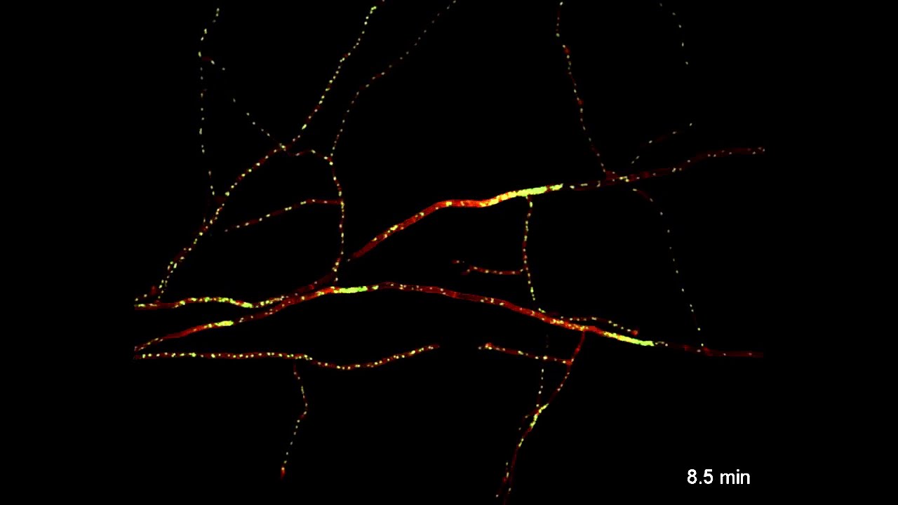 'Nuclear comets' in mycelium of the fungus Neurospora crassa