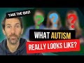 What Autism Really Looks Like How To Spot Autism In Adults
