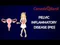 Pelvic Inflammatory Disease PID