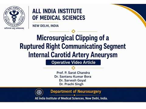 Microsurgical Clipping of a Right ICA Communicating Segment Ruptured Aneurysm