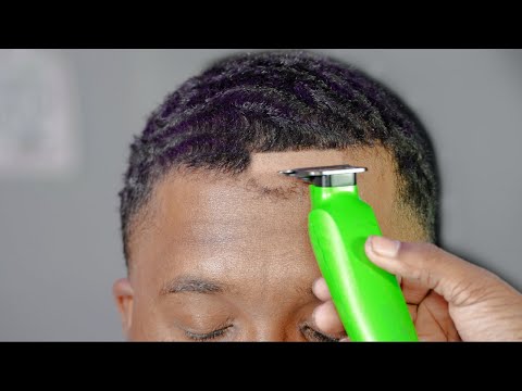 this was the ONLY WAY to FIX his HAIRLINE!