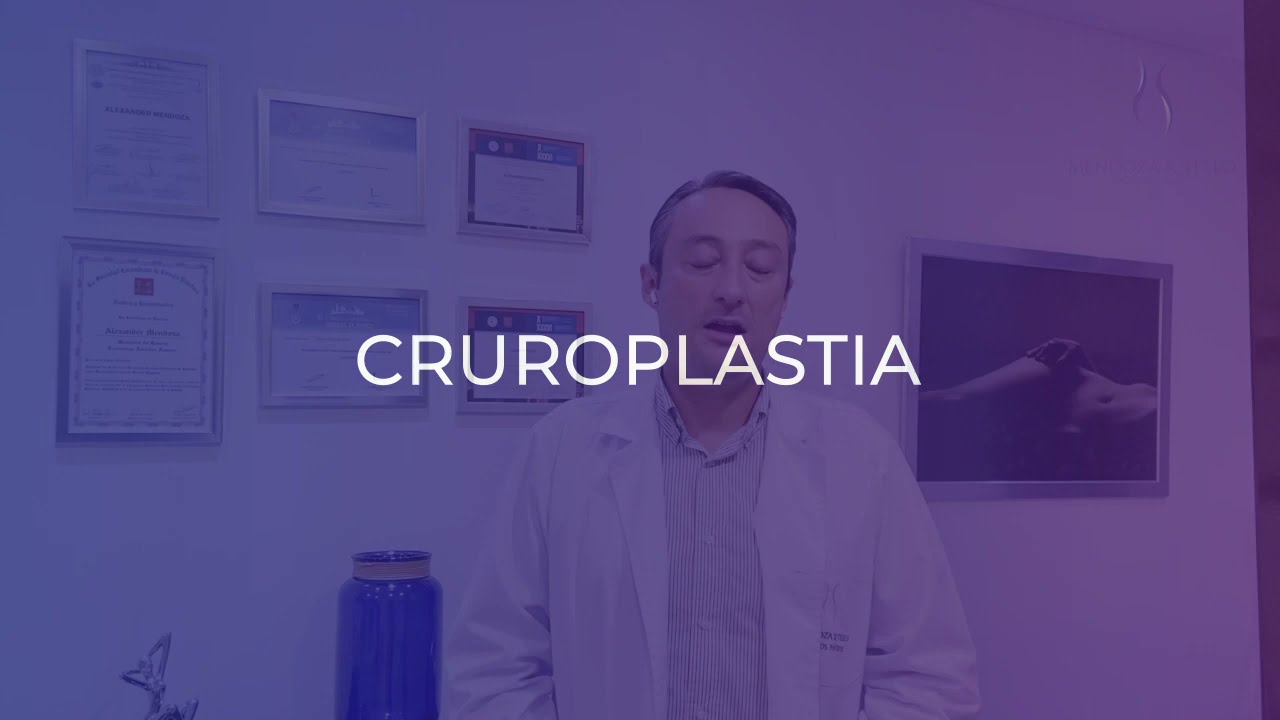 Alexander Mendoza-97