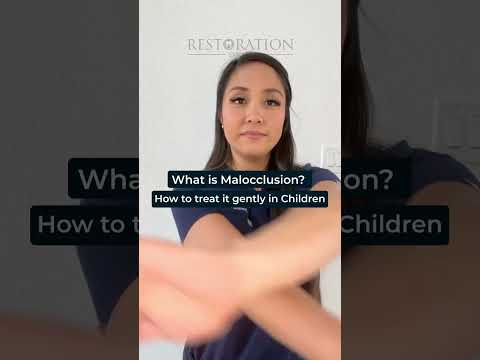 What is Malocclusion?