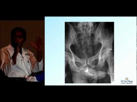 Trauma Day Away 2012 - Pelvic Fractures: A Complicated Injury