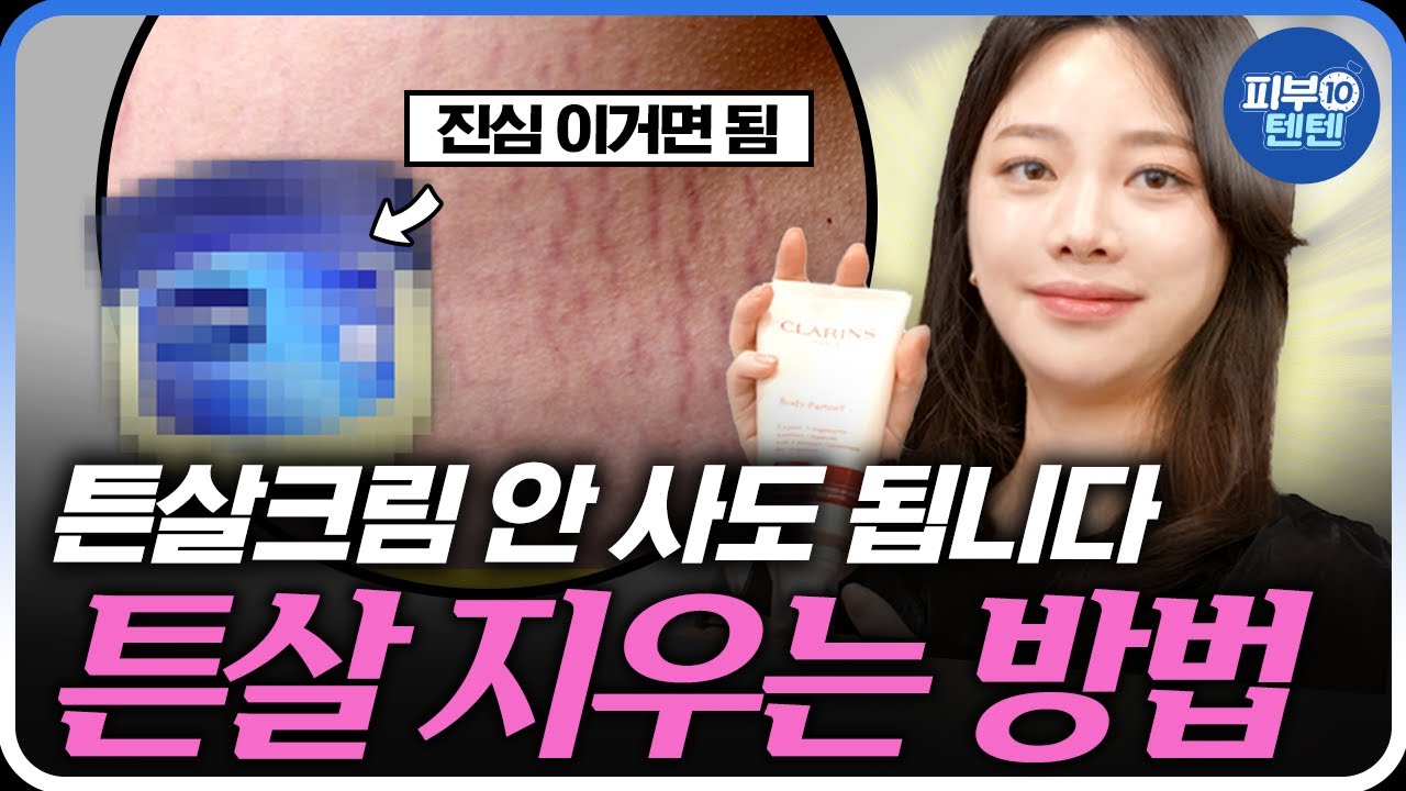 튼살 홈케어 방법 대공개!