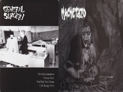 General Surgery / Machetazo - split 7