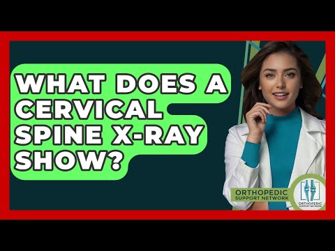 What Does A Cervical Spine X-ray Show? - Orthopedic Support Network