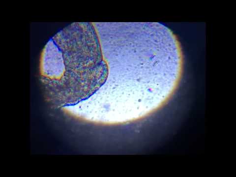 Detritus worm under microscope
