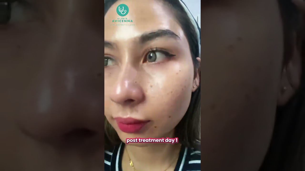 MENYESAL KE? MEMANG TIDAK LA GUYS