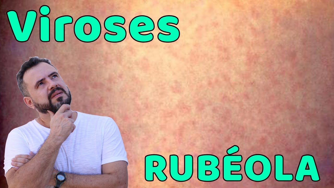 Rubéola
