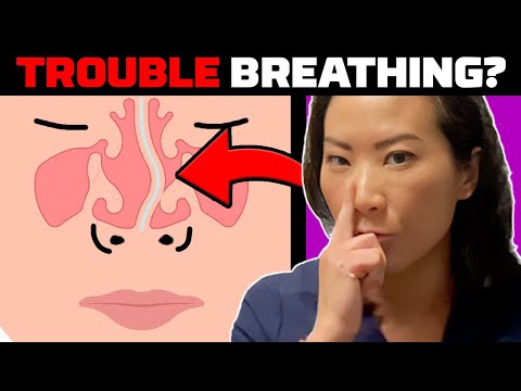 Do I Have A Deviated Septum?! (BREATH BETTER)