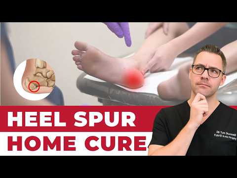 Heel Spurs Plantar Fasciitis BEST Home Treatment 2022