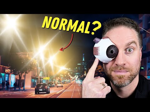 Irregular Astigmatism Vs Regular Astigmatism?