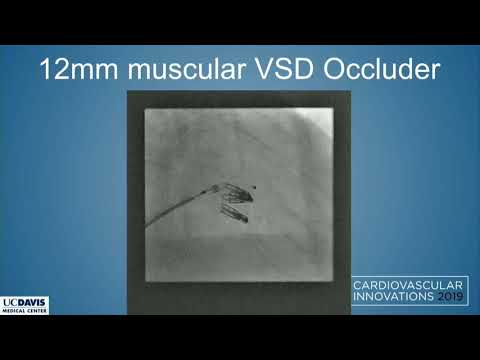 CVI 2019_Saturday, 7/20_ The Boundaries of Structural Heart Therapy III _Gagan Singh, MD