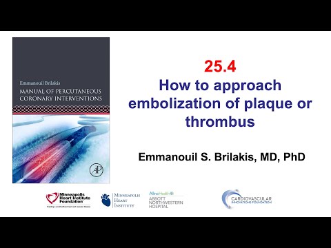 25.4 Plaque and thrombus embolization - Manual of PCI