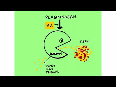 Massive Pulmonary Embolism