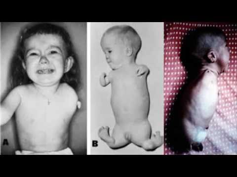 download lagu mp3 mp4 Flipper Babies, download lagu Flipper Babies gratis, unduh video klip Flipper Babies