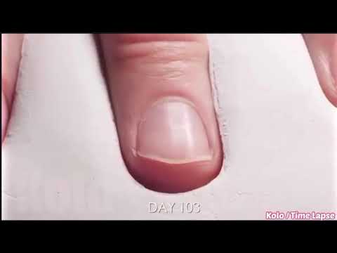 Timelapse Of Finger Nails Growing